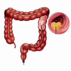 Best Cancer Specialist In Lucknow, best oncologist in lucknow, best cancer doctor in lucknow