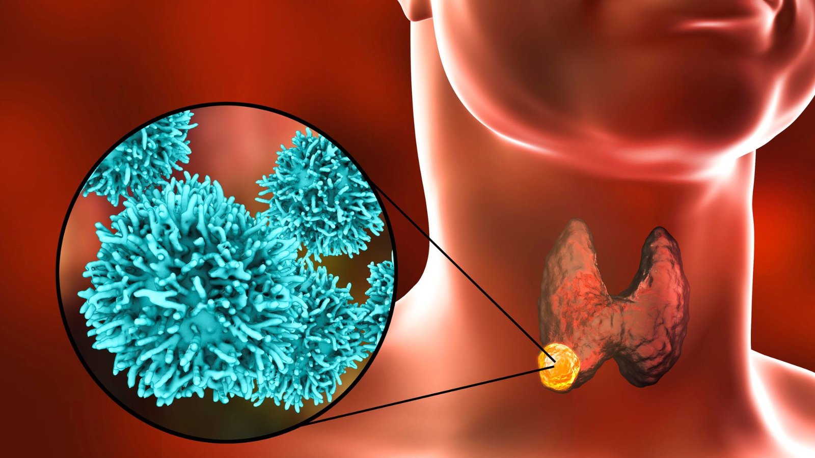 Best Cancer Specialist In Lucknow, best oncologist in lucknow, best cancer doctor in lucknow