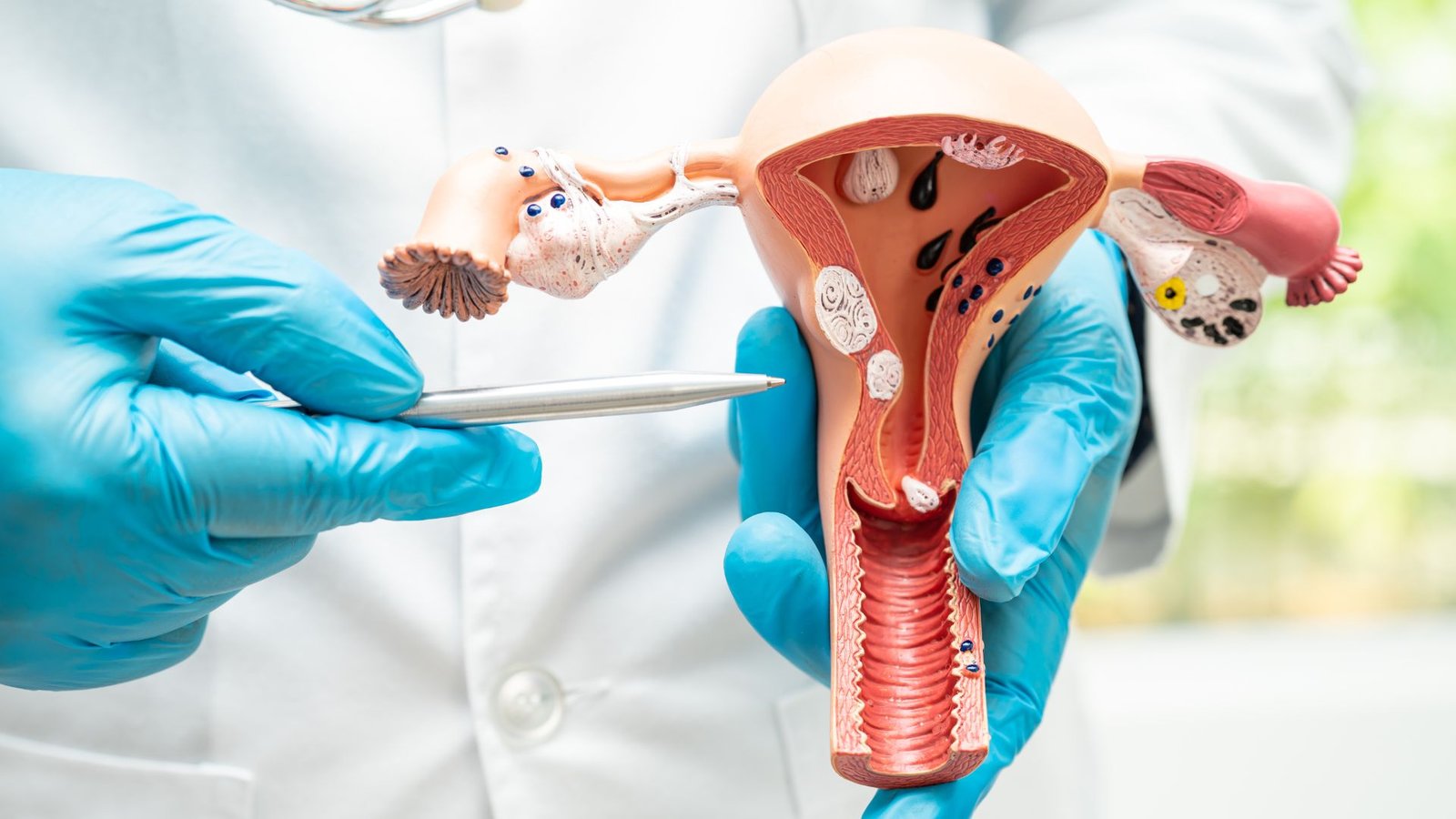 Best Cancer Specialist In Lucknow, best oncologist in lucknow, best cancer doctor in lucknow