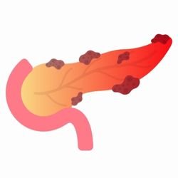 Best Cancer Specialist In Lucknow, best oncologist in lucknow, best cancer doctor in lucknow