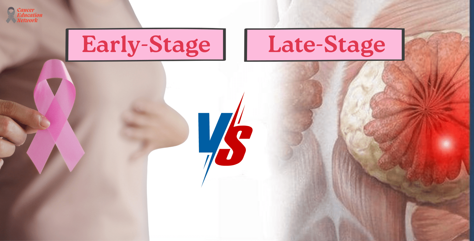 Early-Stage vs Late-Stage   breast cancer Detection 